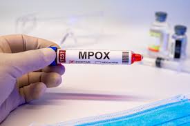 africa-cdc-declares-mpox-a-public-health-emergency