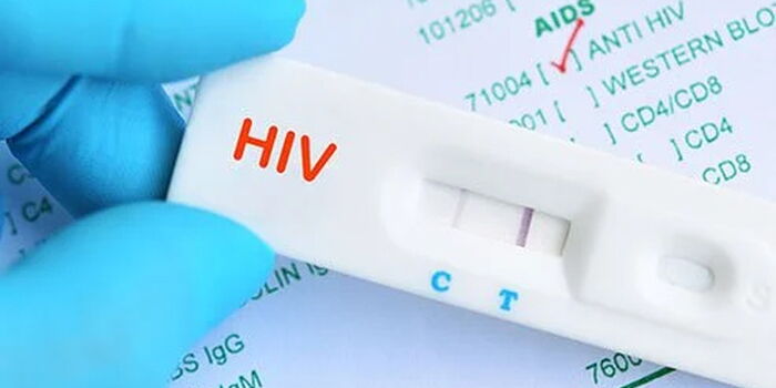 kenya-on-verge-of-accessing-game-changing-hiv-prevention-treatment